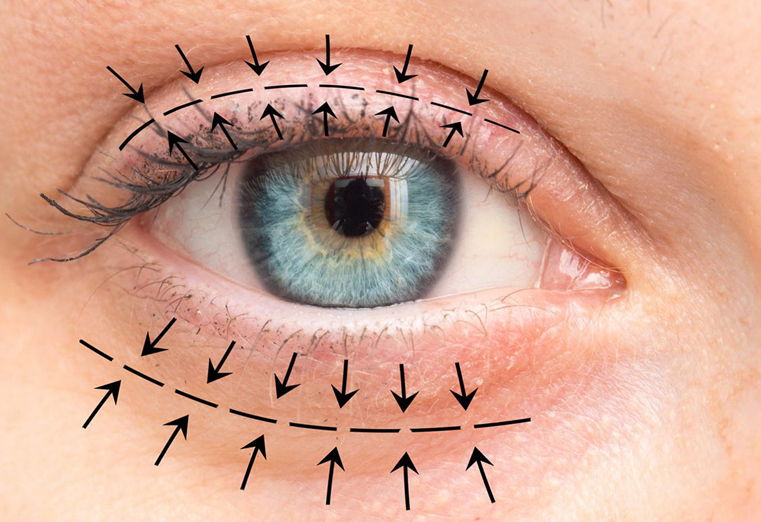 اكتشف أحدث تقنيات تجميل العيون في السقاف لطب العيون. عمليات شد الجفون، تكبير العيون، وتصحيح تجاعيد العين بواسطة أفضل الأطباء