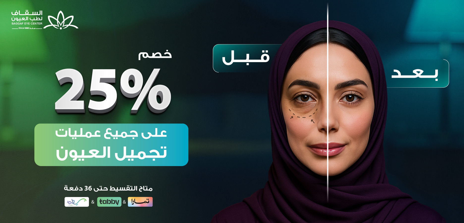 عرض عمليات تجميل العيون