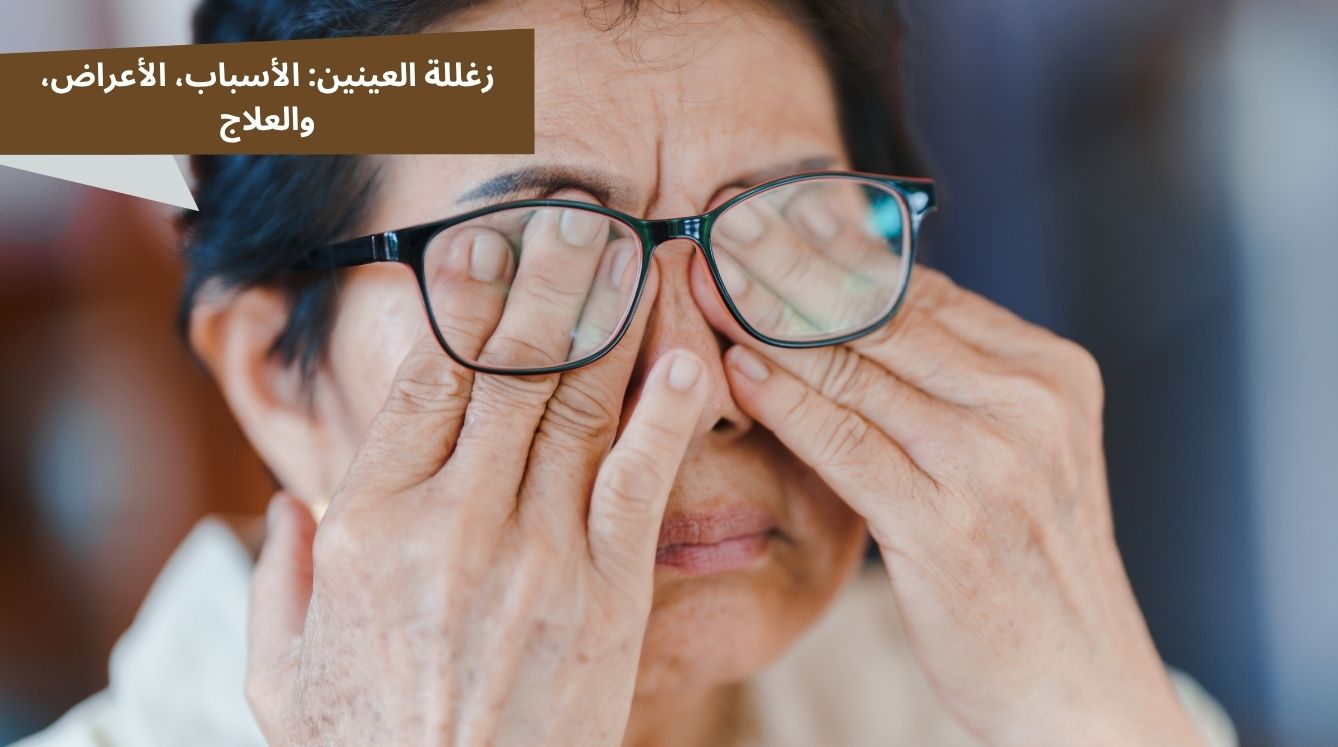 زغللة العينين: الأسباب، الأعراض، والعلاج
