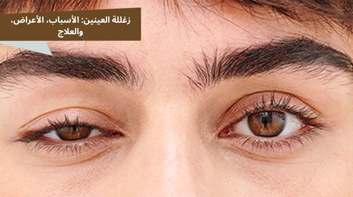 ارتخاء الجفن العلوي قبل وبعد العلاج الجراحي في مركز السقاف لطب العيون بجدة