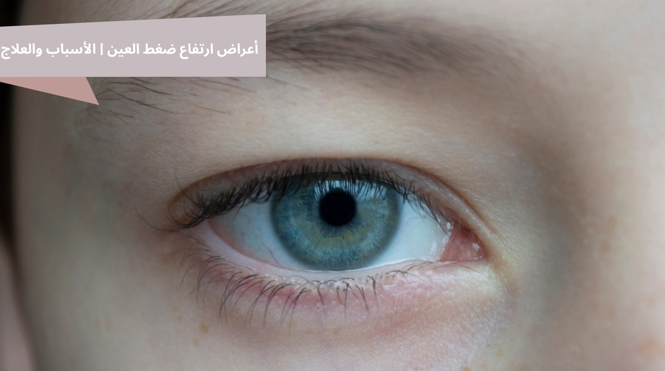 أعراض ارتفاع ضغط العين | الأسباب والعلاج